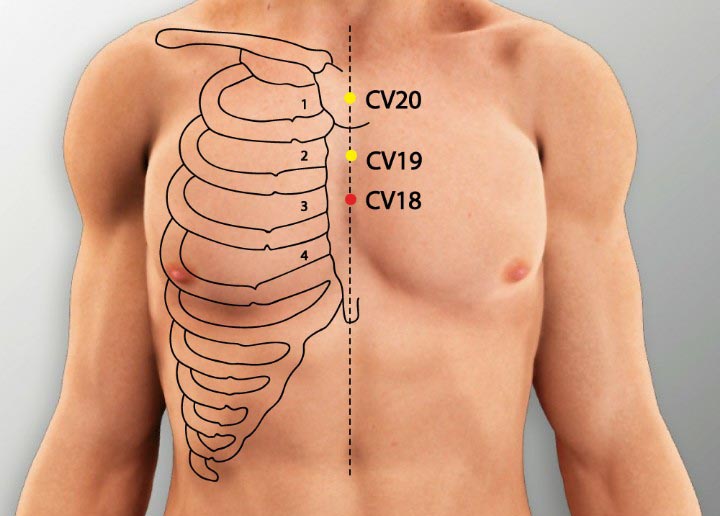 נקודת דיקור התעברות CV 18