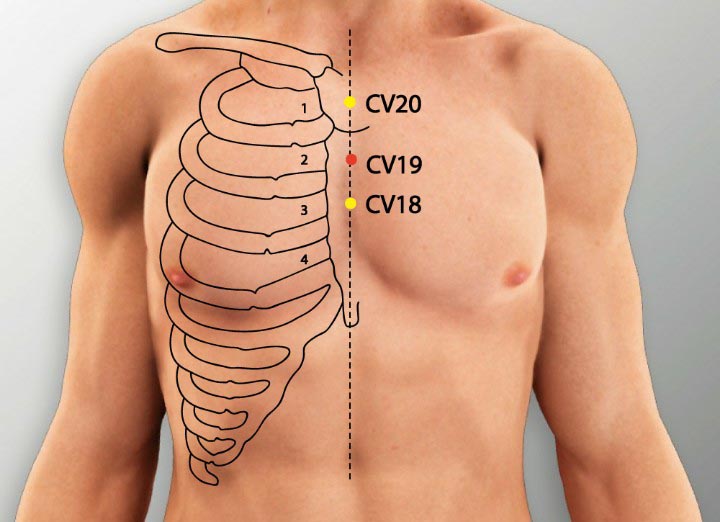 נקודת דיקור התעברות CV 19