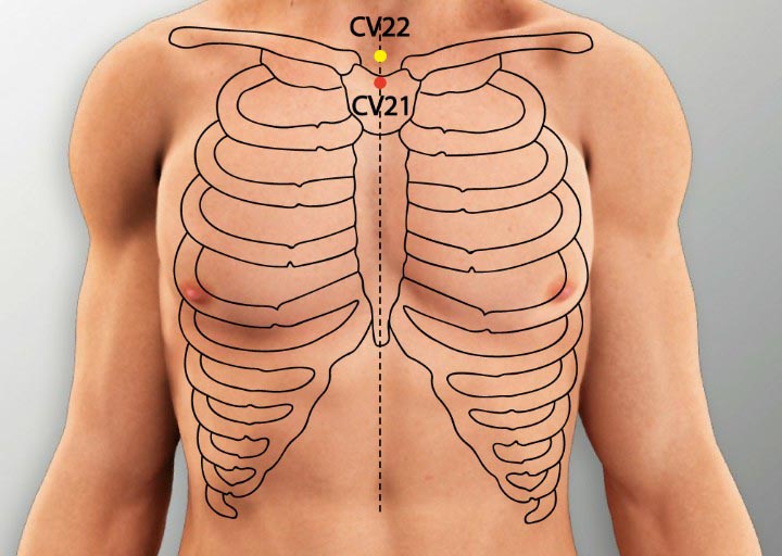 נקודת דיקור התעברות CV 21