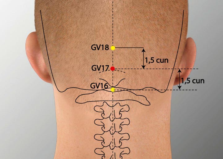 GV17 acupuncture point location - Acupoints.org