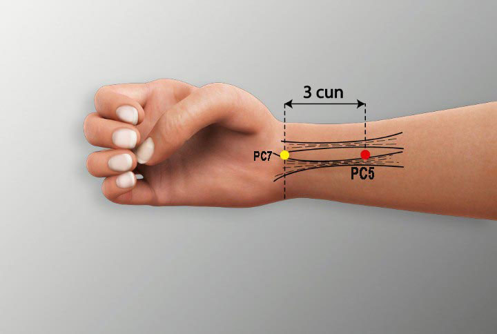 PC5 acupuncture point location - Acupoints.org